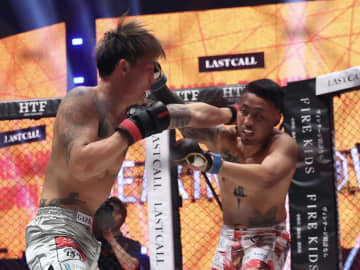 激闘代償に騒然「鼻と眼窩内側壁が折れました」BD劇的勝利の42歳元アウトサイダーの告白に驚きの声「ヤバすぎる」「相当な衝撃だったはず」