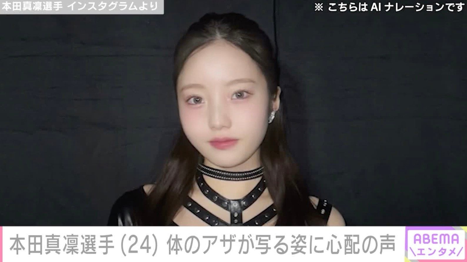 本田真凜選手、体にできた大きなアザが写る姿に心配の声「痛々しい」「けがだらけやん」「すごく痛そう」