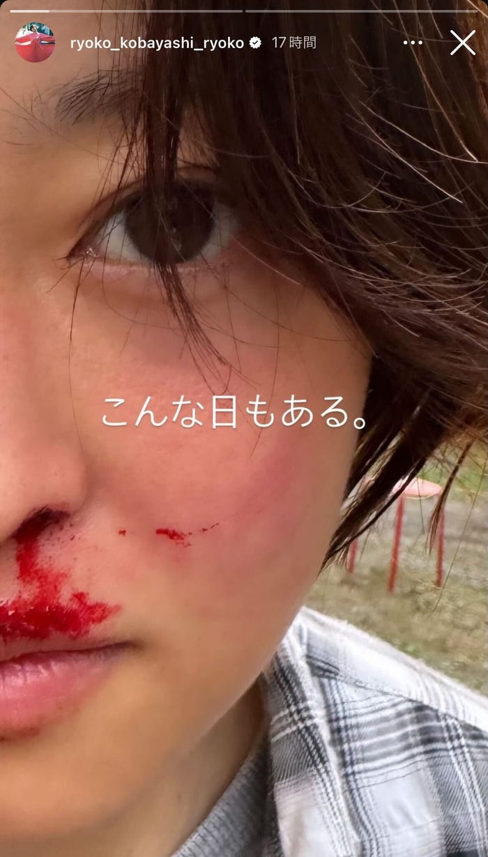 小林涼子 Instagramストーリーズより