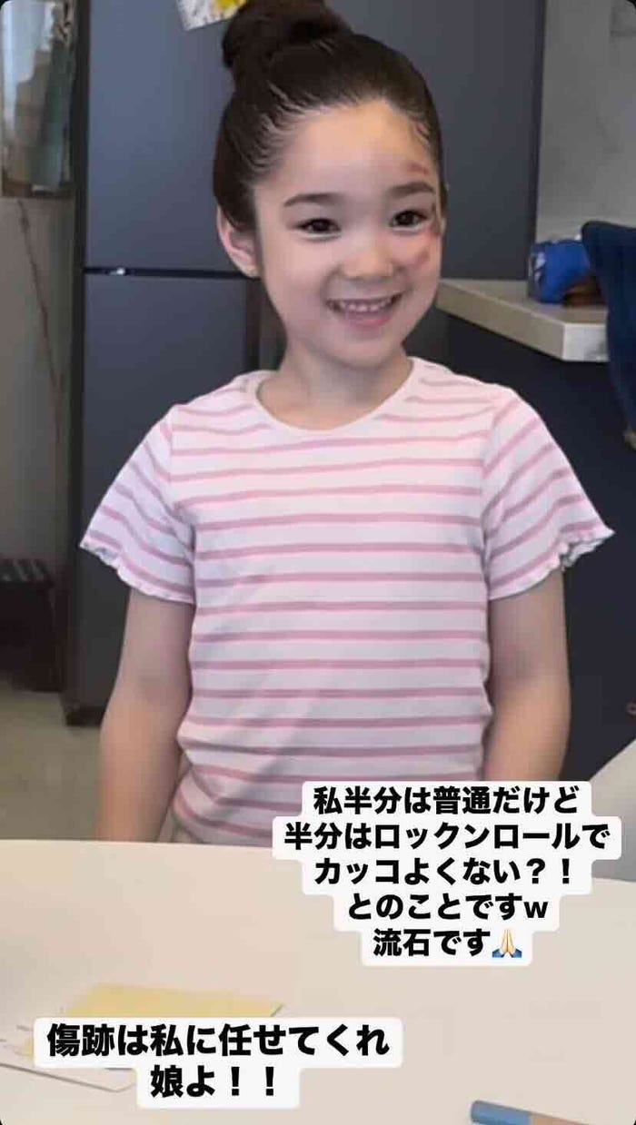 紅蘭Instagramストーリーズより