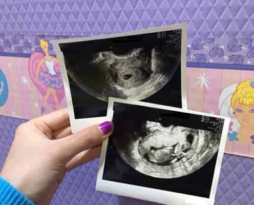 ぺこ第1子妊娠、エコー写真公開 性別は?