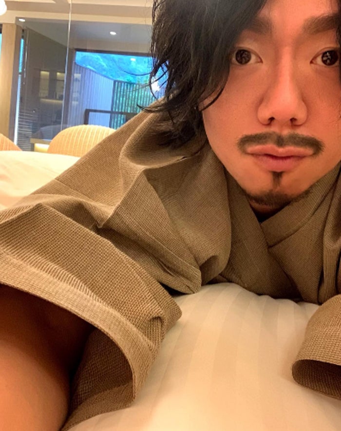 カマたく、人中短縮＆眉下切開の整形報告 ダウンタイム中の自撮りも公開「マジこいつ誰？」「顔が腫れてめちゃくちゃおもろい」