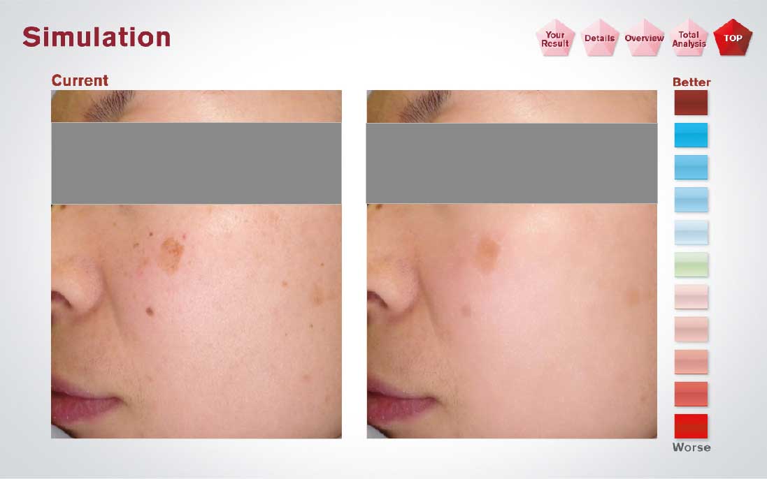 将来の肌を段階的にシミュレーションも　※イメージ画像