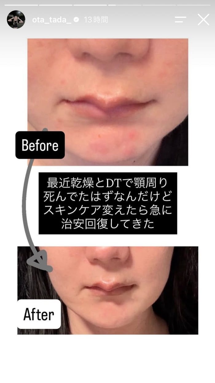 多田さんInstagramストーリーズより