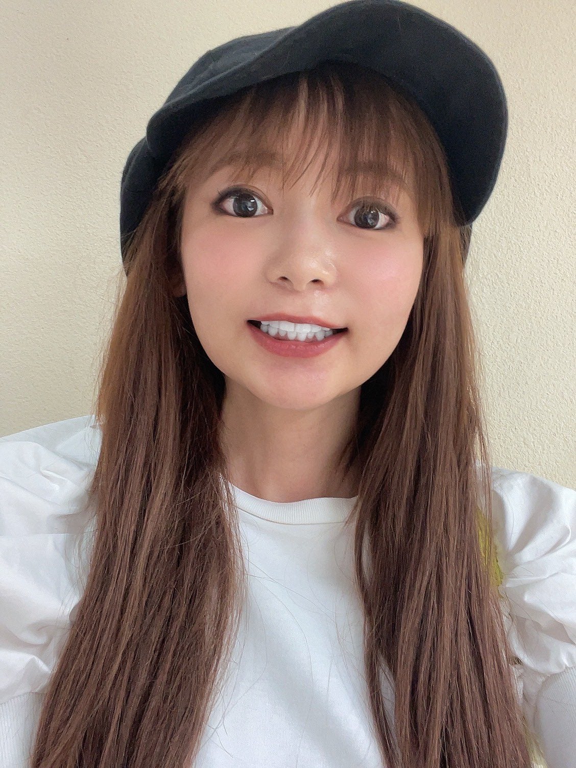 中川翔子、歯の美白治療を報告「歯を見せて笑うのが苦手だった」