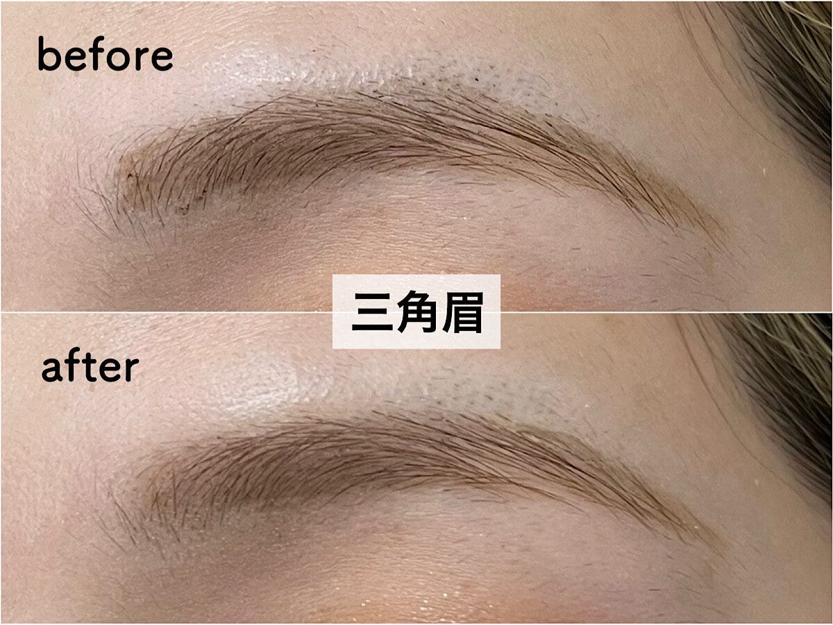 三角眉beforeafter