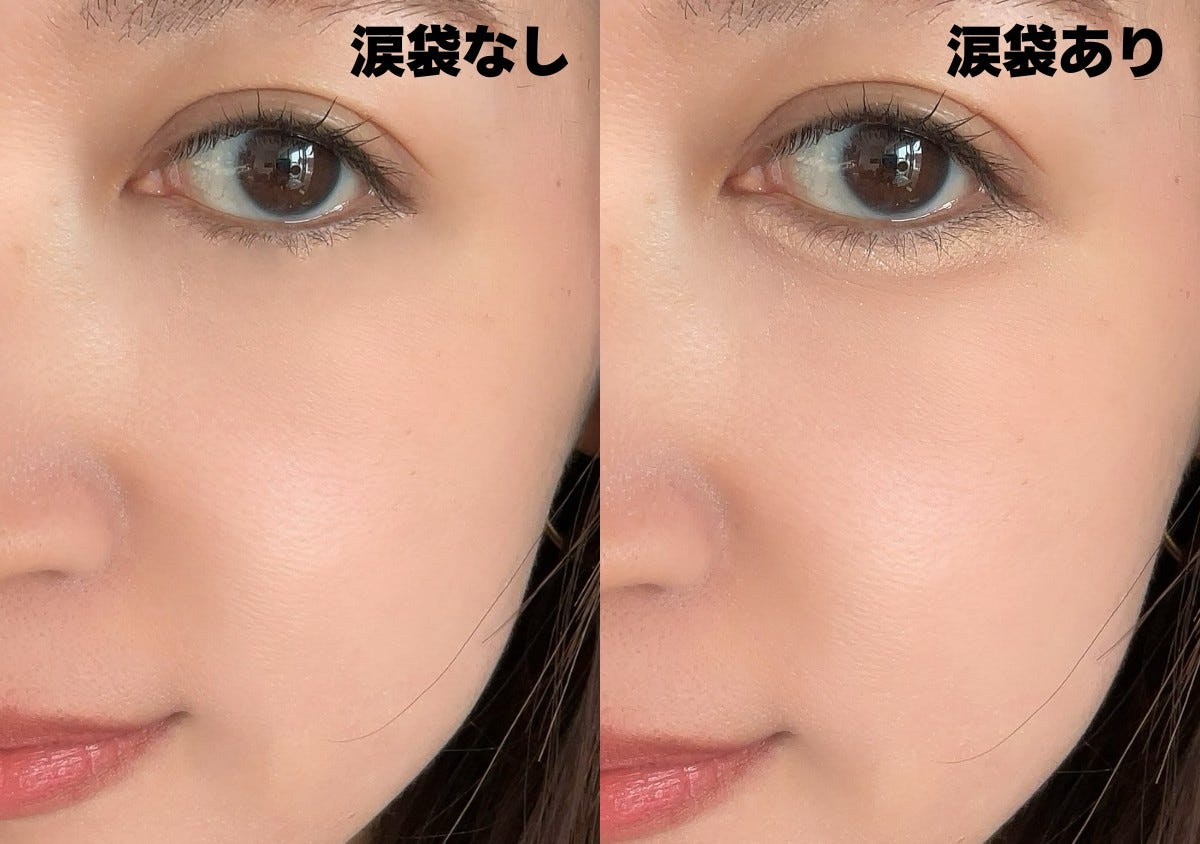 涙袋なしと涙袋ありの目元の比較