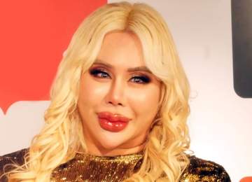 アレン様「全財産をカジノで失う」「1日1回バッグを替えても使えない」1億円の美容整形も話題に 散財ぶりが規格外