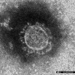 兵庫県で新たに2人感染 代女性と50代男性 モデルプレス