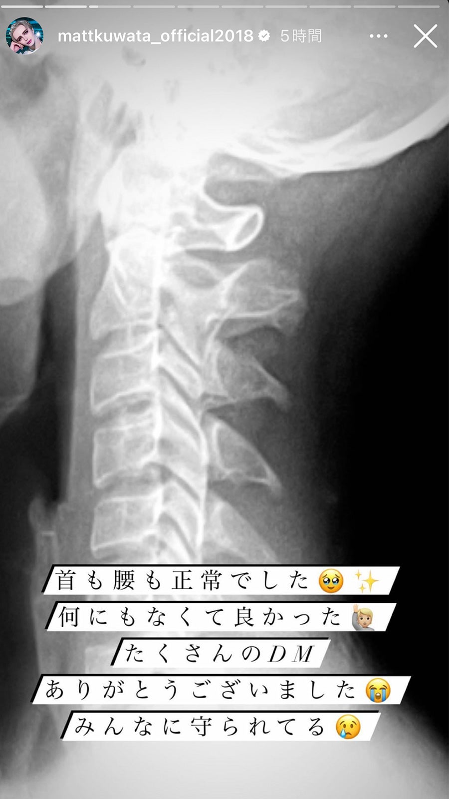 Matt、Instagramストーリーズより