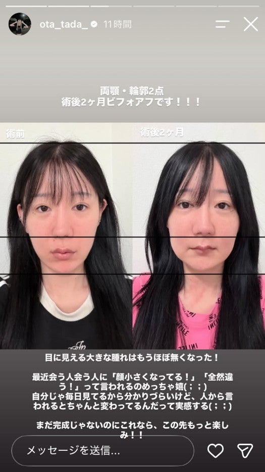 多田さんInstagramストーリーズより