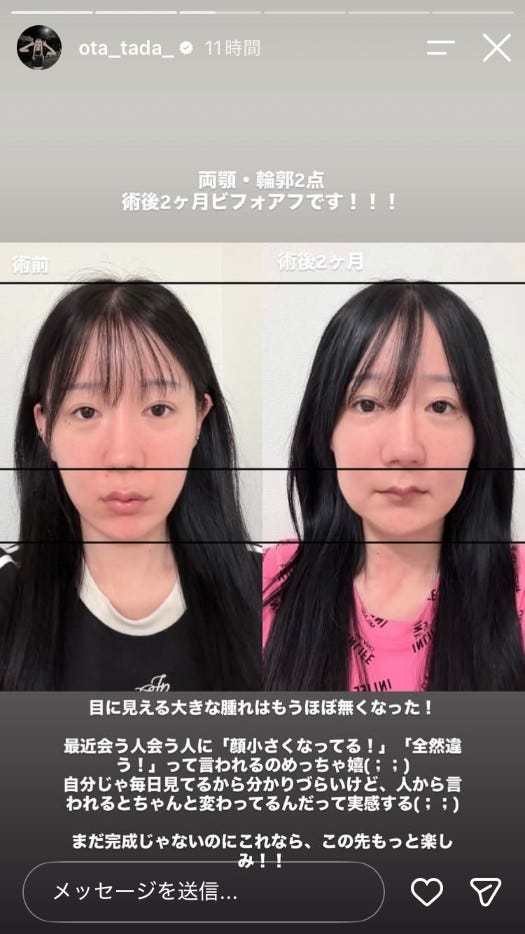 多田さんInstagramストーリーズより