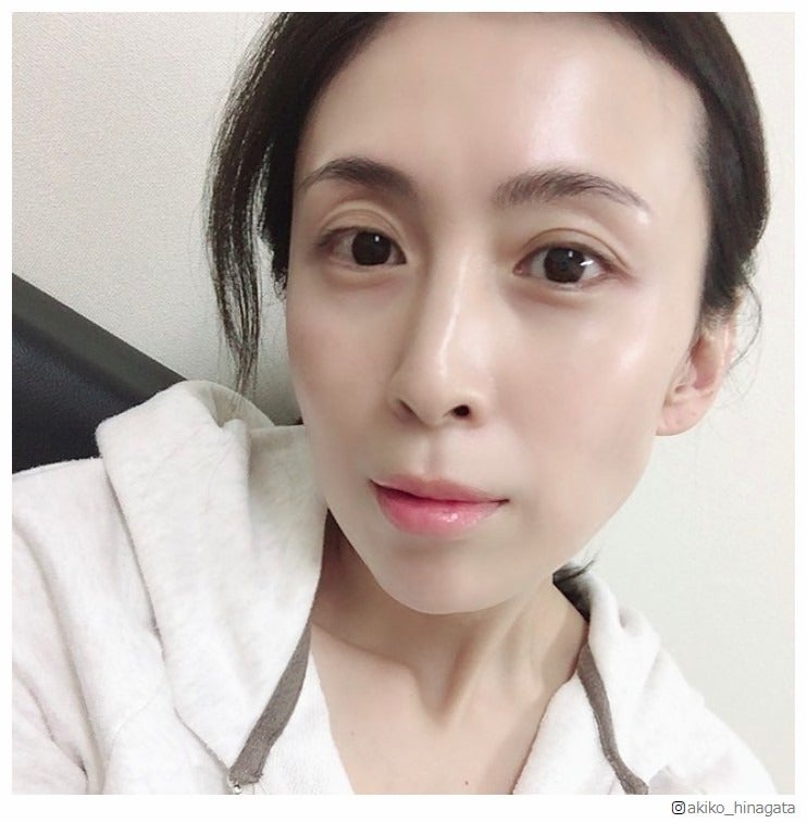 雛形あきこのすっぴん美肌に「透明感がすごい」「まさに陶器肌」と注目集まる