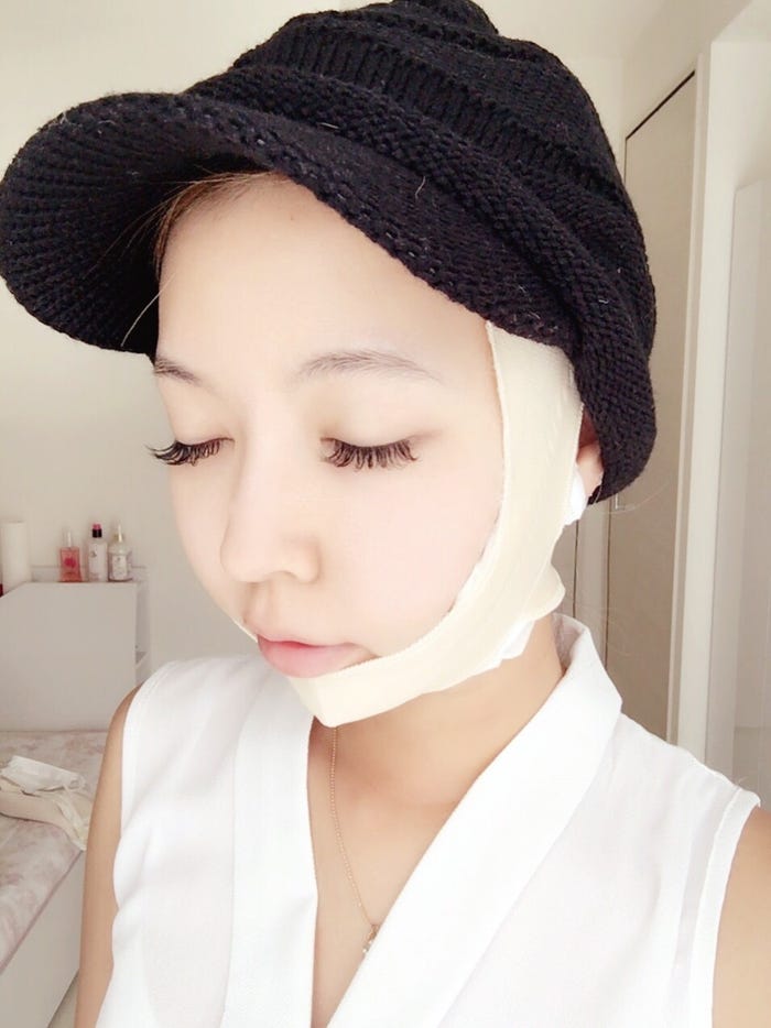 吉川ちか/手術後(画像提供:所属事務所)