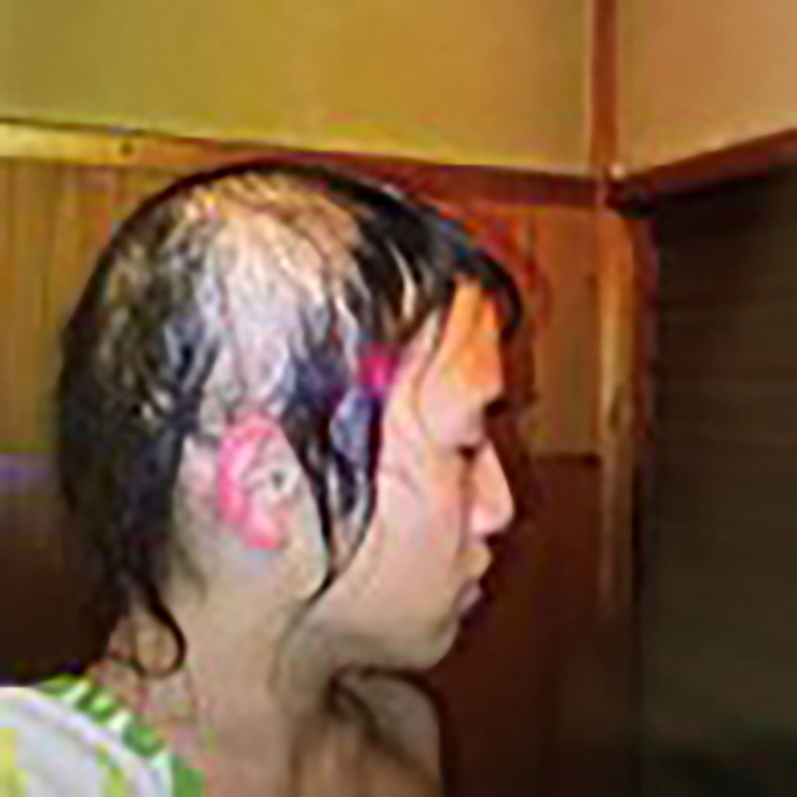 円形脱毛症を告白したおおしましゅん（提供写真）