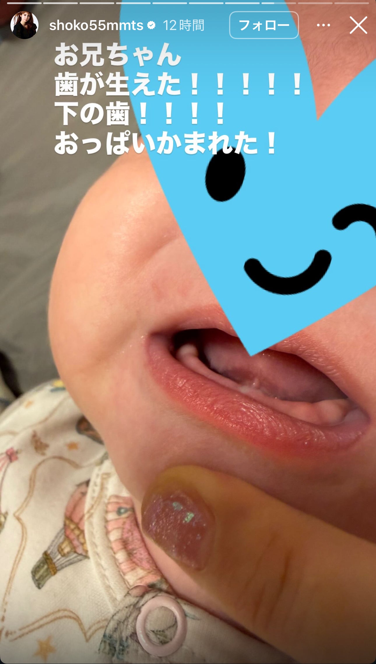 中川翔子Instagramストーリーズより