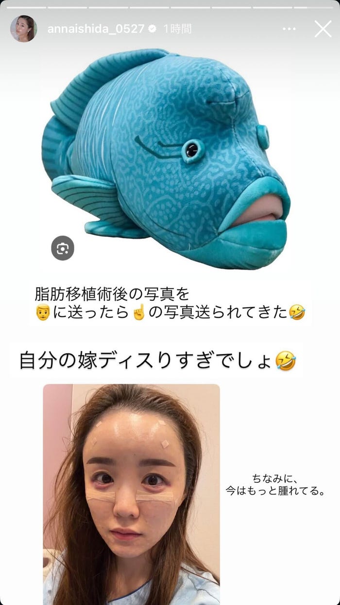 石田安奈Instagramストーリーズより