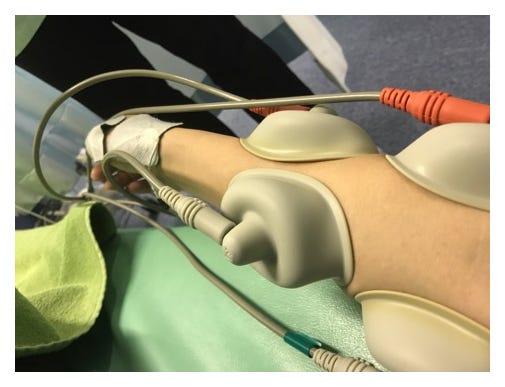 治療中の右腕写真/桃オフィシャルブログ(Ameba)より