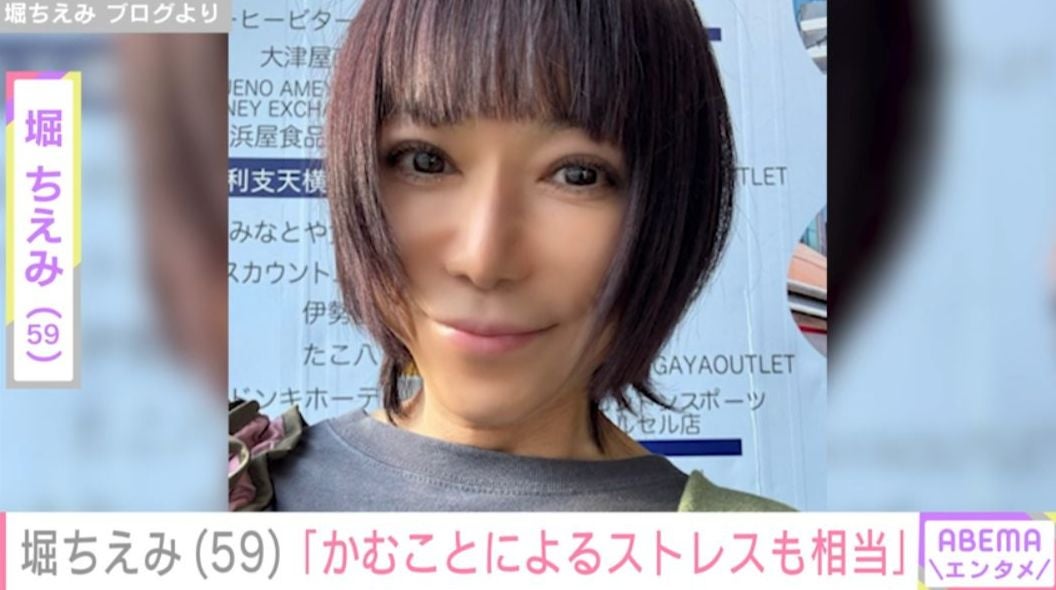 “舌がんのため6割切除”堀ちえみ（59）「舌が普通ではない分 かむことによるストレスも相当」