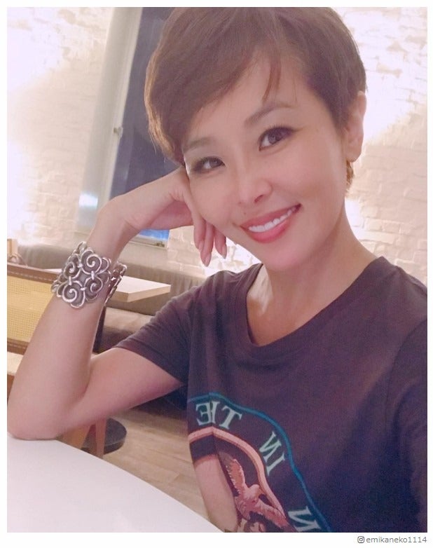 CM100本以上出演の“手タレ”金子エミ、手の痛み訴える