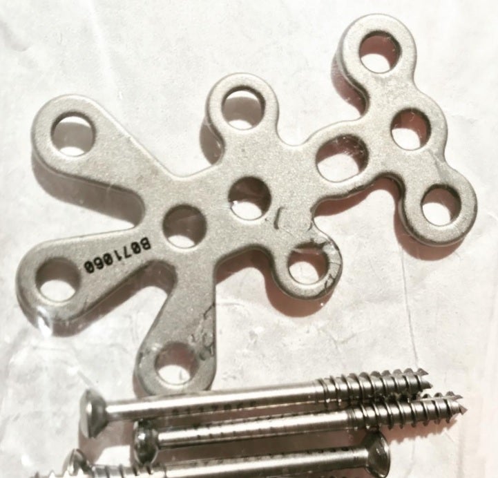 伊勢谷友介、手術後の投稿写真にファン驚愕「こんなのが体に入っていたなんて…」「考えただけで痛い」