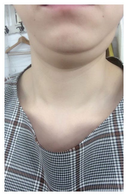 二重あごを公開/高橋真麻オフィシャルブログ(Ameba)より