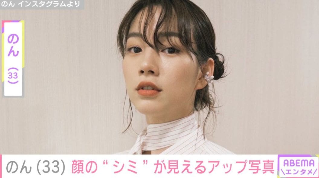 のん（33）、顔の“シミ”が見えるアップ写真に「めっちゃ可愛い」「ラフな格好でどこで撮っても絵になる」など反響