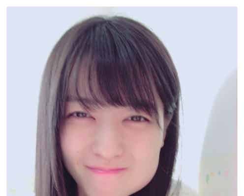 親知らず上下同時抜歯の矢島舞美、顔写真を公開「笑っちゃった」