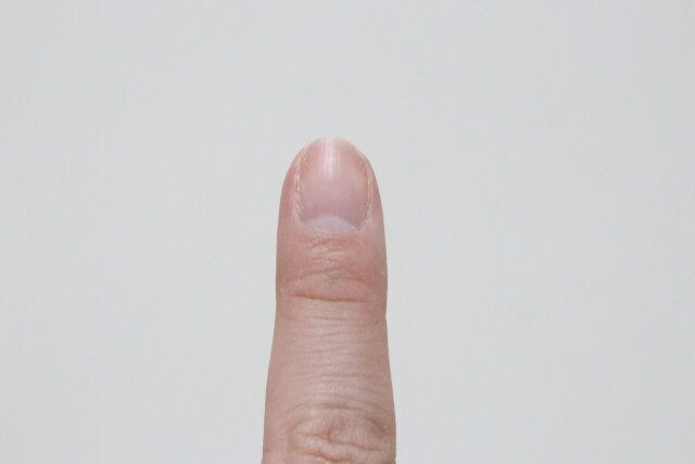 ラウンド型の爪に整えられる