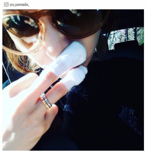 第2子妊娠中の山田優、怪我で包帯姿「めちゃ痛かった」