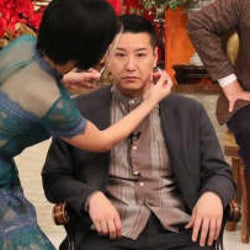 チョコプラ長田の顔が怖すぎて仕事に影響が!?解消には美容医療がいい?効果と費用は…