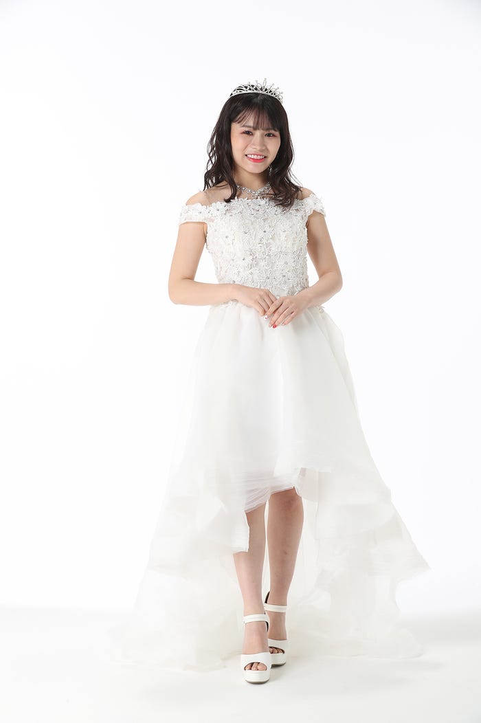 尾上七海さん/整形後 (提供写真)