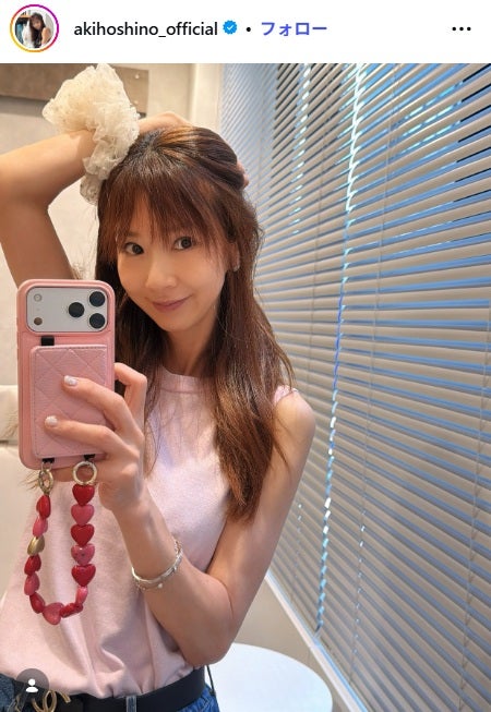 ほしのあき「ヒアルロン酸でほうれい線を埋めるより自然な感じに仕上がるみたい」肌育注射後に「美しすぎて二度見した」「ナチュラルな感じが素敵」と反響