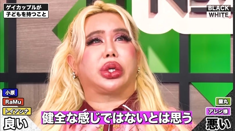 アレン様がゲイカップルが子どもを持つことに反対する理由は「健全な感じではないなと…」