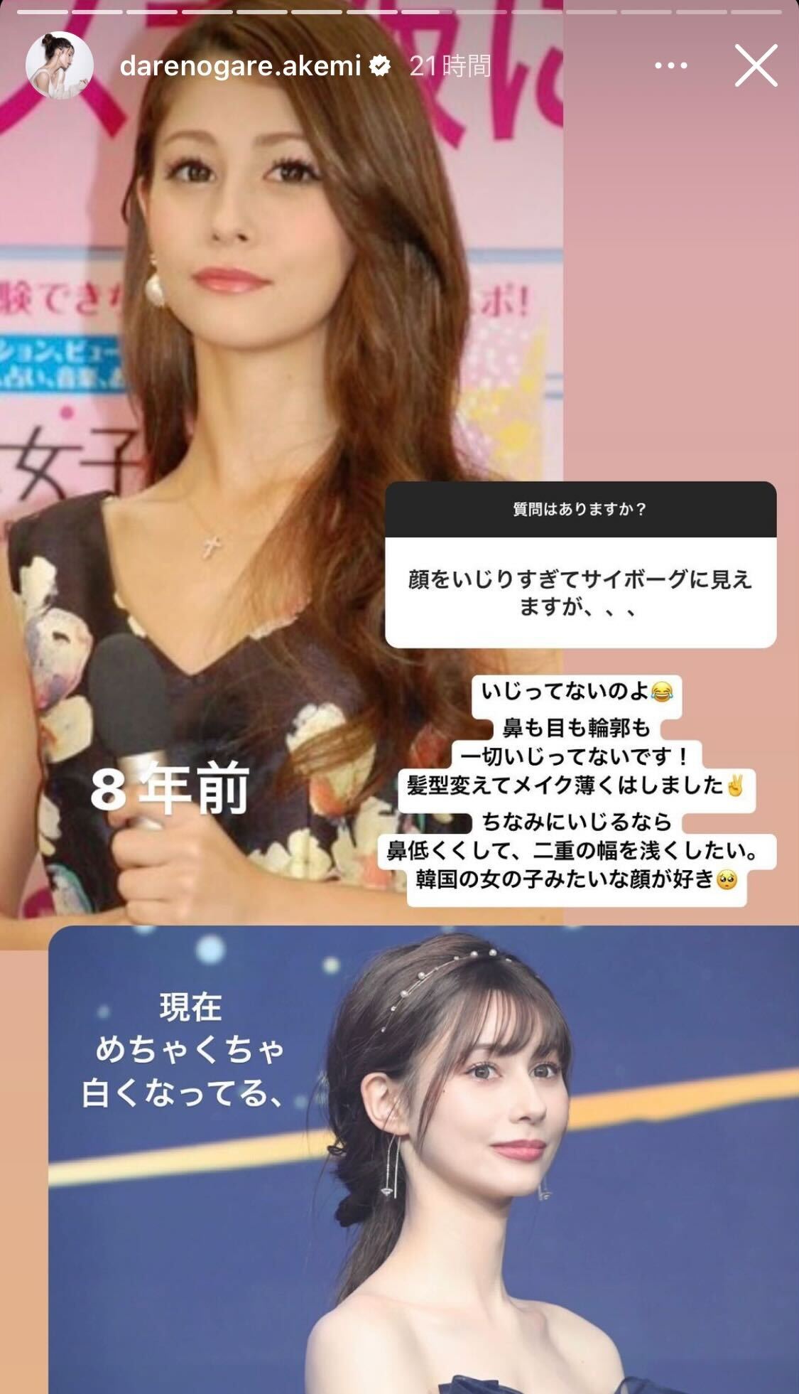 ダレノガレ明美公式Instagramストーリーズより