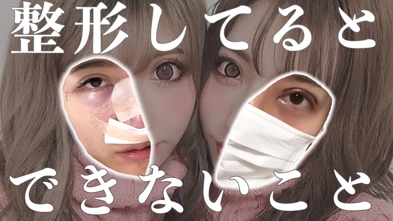 双子モデル“ちえちか”「整形してるとできないこと」暴露動画が100万回再生突破