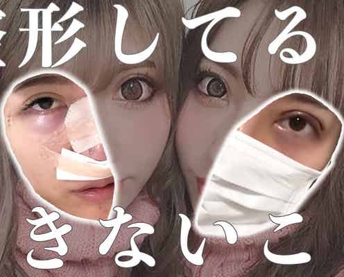 双子モデル“ちえちか”「整形してるとできないこと」暴露動画が100万回再生突破