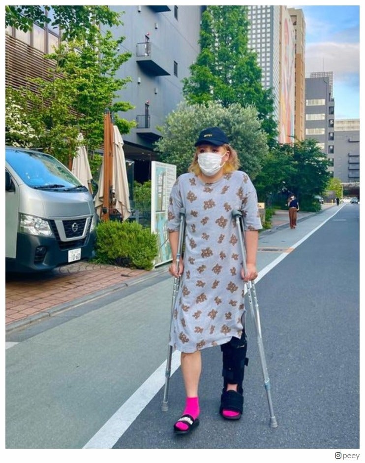 左アキレス腱断裂のぺえ、車椅子生活終える イメチェン姿も公開