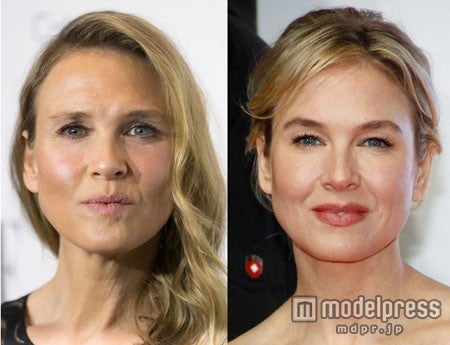 昨年10月（左）と2011年（右）でこんなに顔が変わっていました。WENN.com ／ Zeta Image