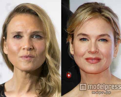 レニー・ゼルヴィガー、3年間で顔が激変の謎