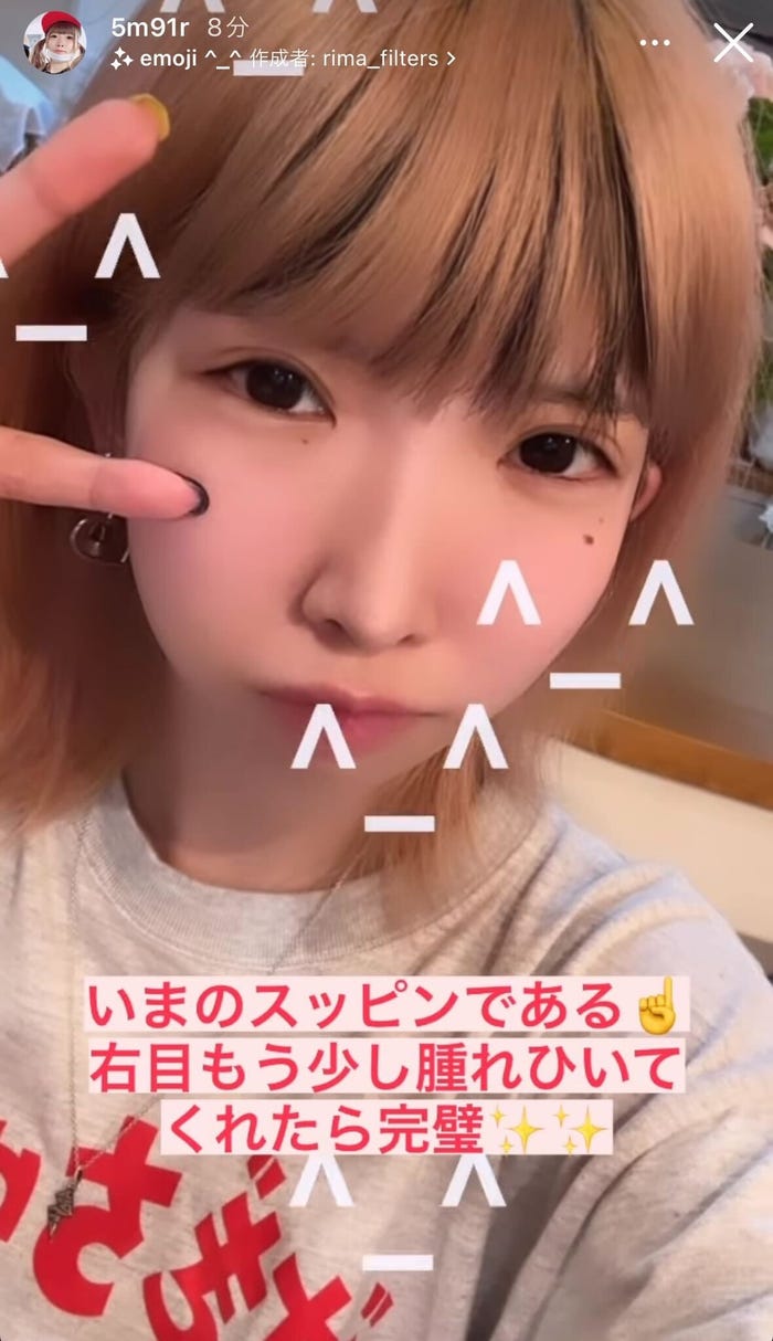 まあたそ整形後の近影/まあたそ公式Instagramストーリーズより