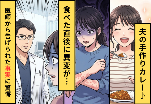 夫の【手作りカレー】を食べた妻に蕁麻疹が！？病院で⇒医師から告げられた“一言”に、血の気が引いたワケ