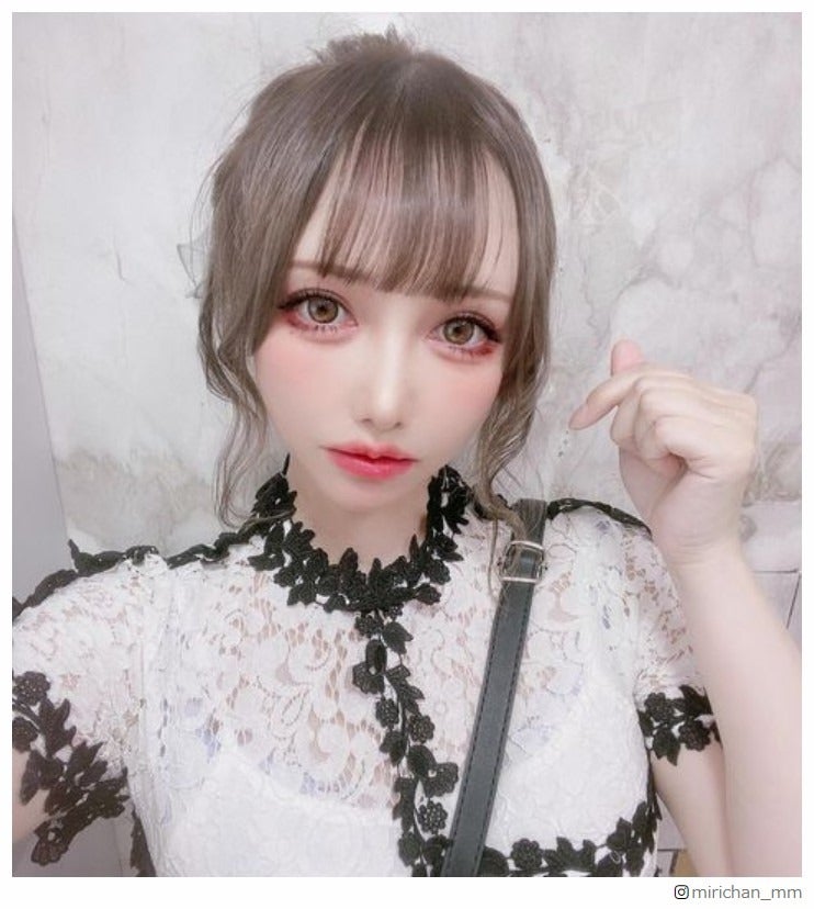 40歳の現役アイドル・MiRichan、“総額300万”の脂肪吸引・10箇所以上の整形事情明かす