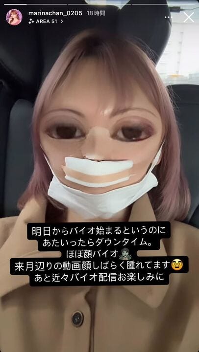 まりなInstagramストーリーズより