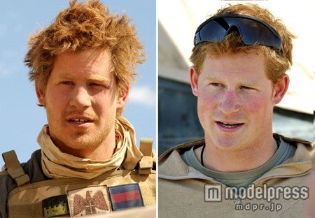 英ハリー王子（28歳）、クラウンエリアの頭髪が！