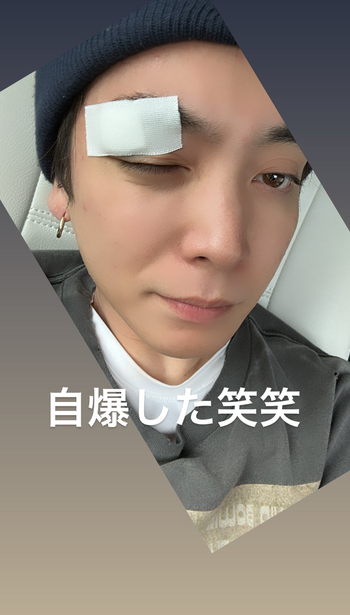 優里、瞼を縫う怪我に心配の声「何があったの」「大丈夫？」