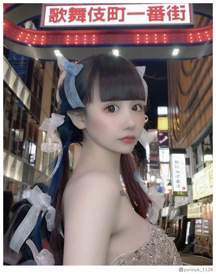 “骨格ウォニョン”で話題のゆりにゃ、目の整形を報告 ダウンタイムの様子も公開