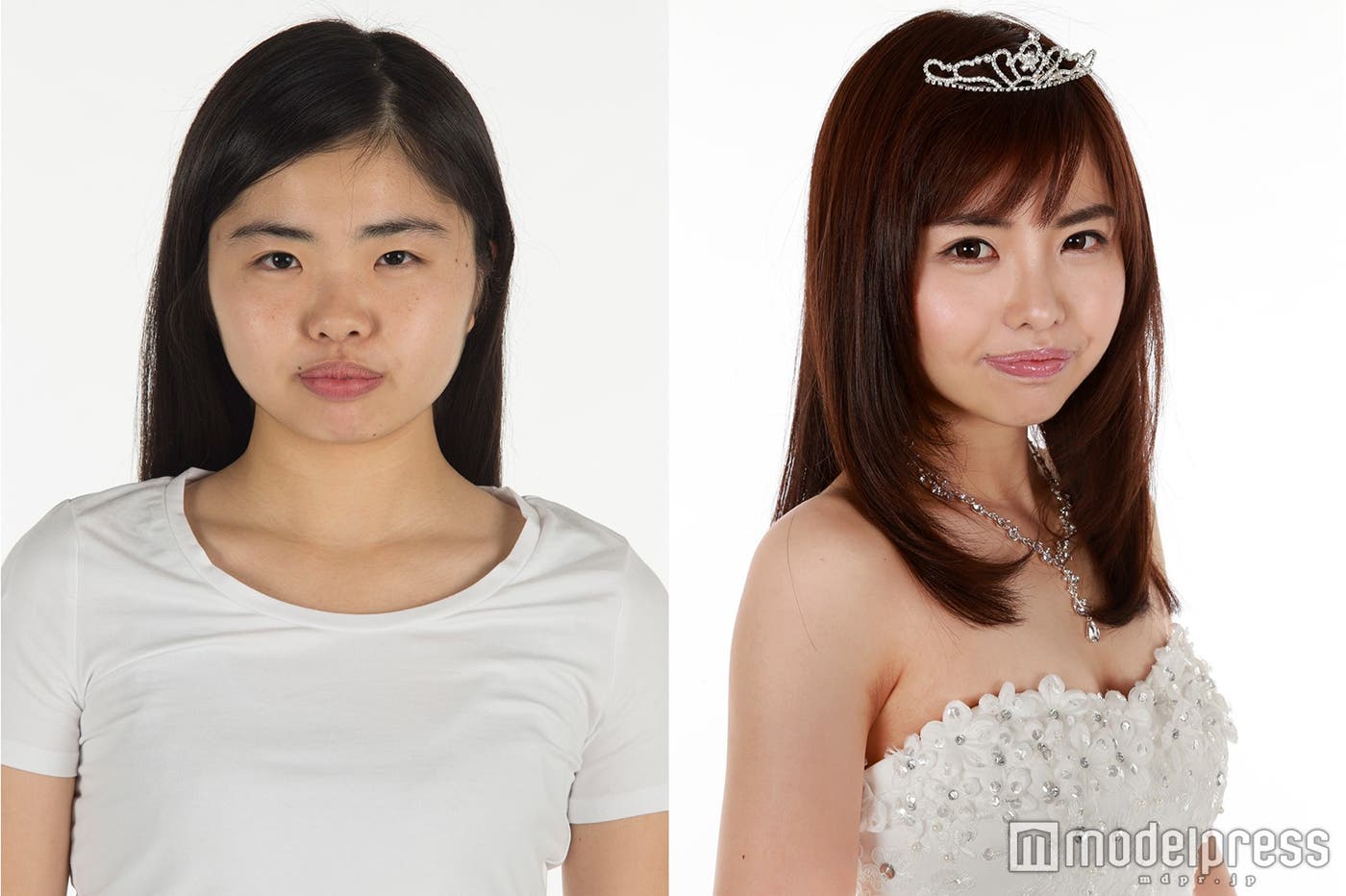 笹野千枝里さんの整形ビフォー(左)&アフター(右)