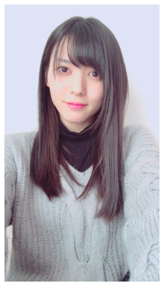 抜歯直後の写真/矢島舞美オフィシャルブログ(Ameba)より