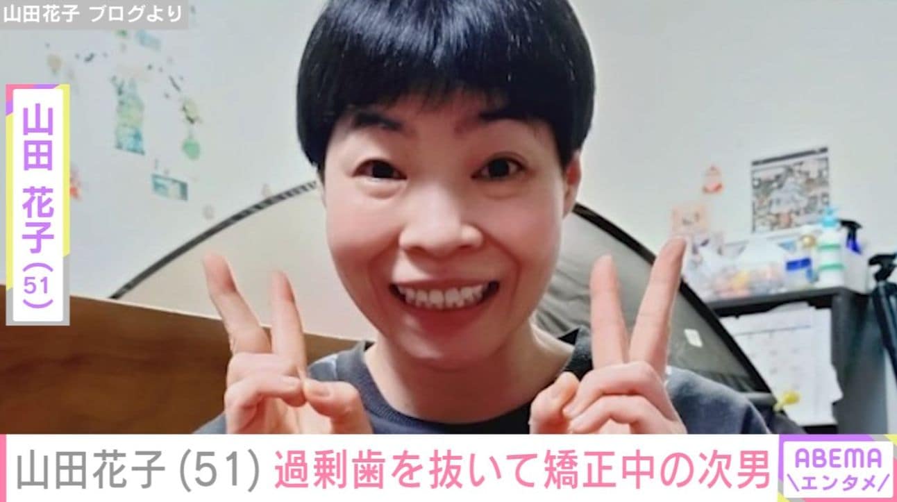 山田花子（51）、過剰歯を抜いてマウスピースで矯正している次男の様子を公開